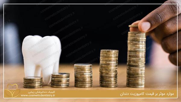 موارد موثر بر قیمت کامپوزیت دندان