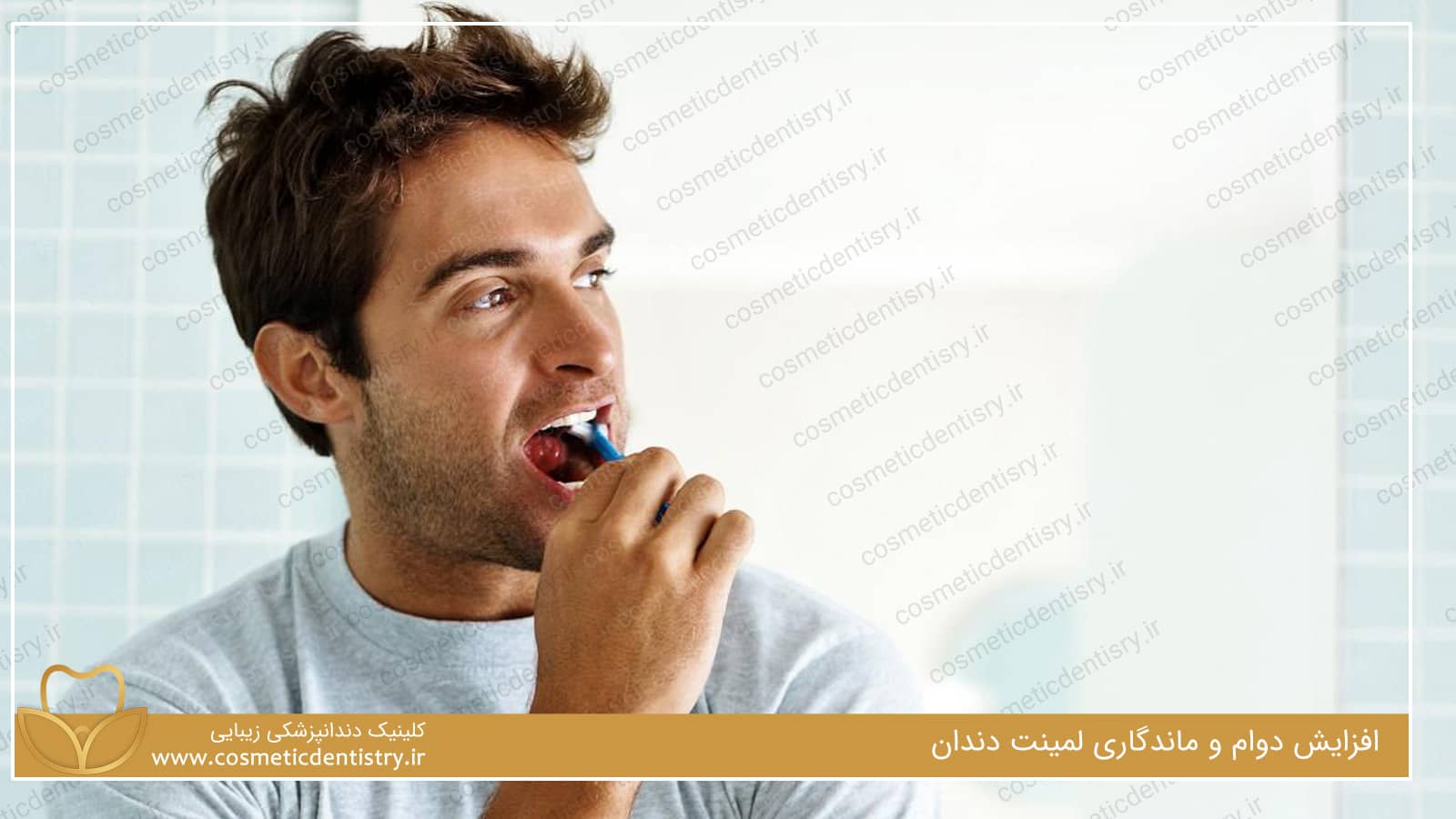 افزایش دوام و ماندگاری لمینت دندان