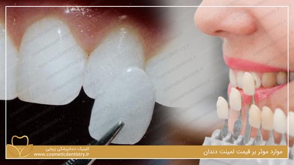 موارد موثر بر قیمت لمینت دندان